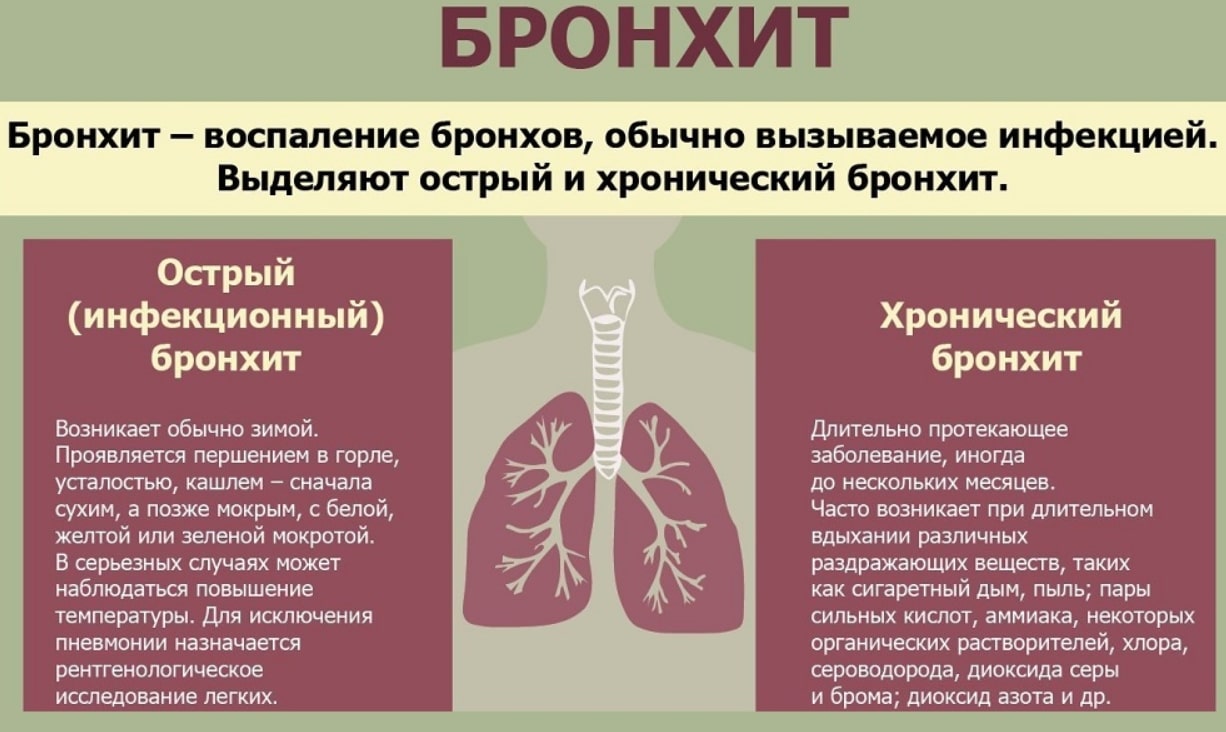 Р картина бронхита что это