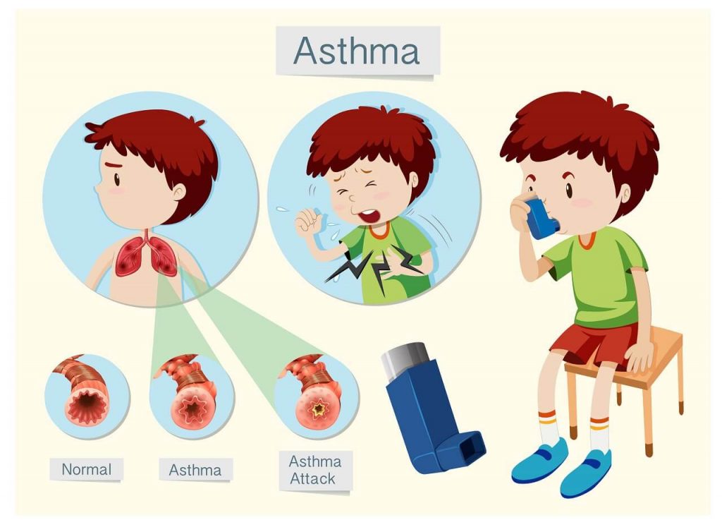 Профилактика астмы